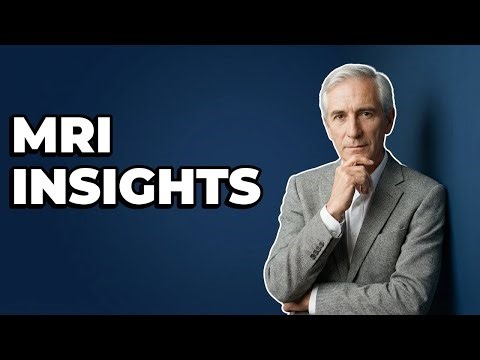 What Do Doctors Look For On Stroke MRI?