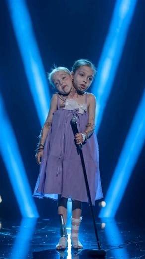 307K views · 16K reactions | Conjoined Twin Sisters Deliver Emotional AGT Performance That Brings the Audience to Tears | Cute Kid Moments | Facebook