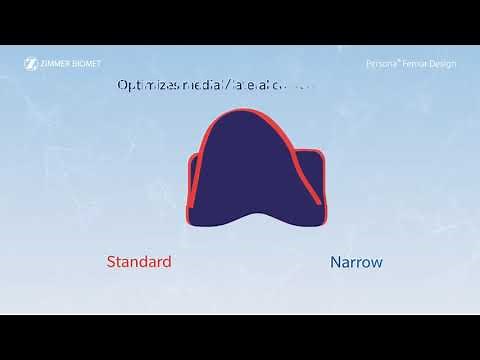 The Original Personalized Knee Persona