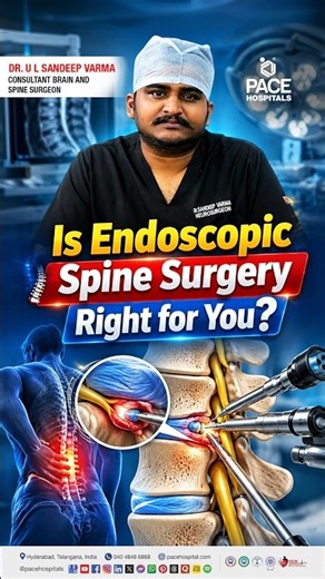 Is Endoscopic Spine Surgery Right for You? | Indications for Spine Surgery | Dr. Sandeep Varma