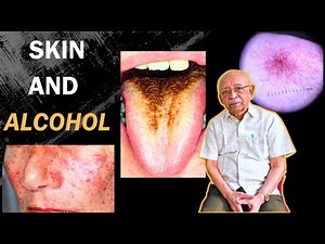How Alcohol Changes Your Skin (Dermatology Professor Explains)