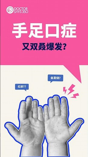 【手足口症】儿科医生揭秘：传染方式、症状，预防与治疗！#手足口病