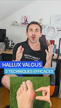HALLUX VALGUS: 3 Effective Tips