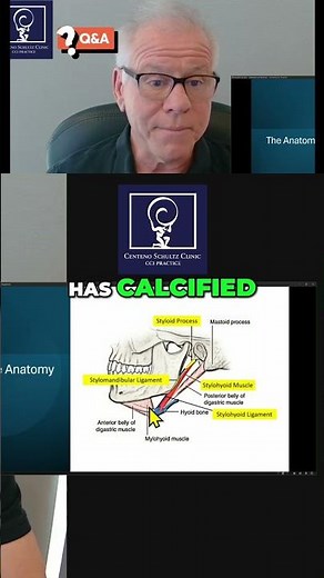 Styloidectomy Explained: Beyond the Common Conception #shorts