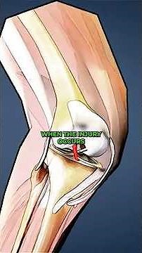 Why Athletes Get Injured (and How to Fix It!)