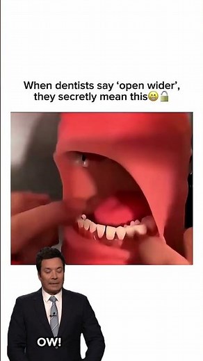 when dentist say 'open wider' they secretly mean this 😬🦷