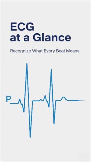 Pulsecheck MD on Instagram: ""Identify & track the error in the ECG." ECG at a glance ❤️‍🩹 Know the rhythm, save a life! 🫀@pulsecheck_md #ECG #Cardiology #HeartCare #MedicalEducation #CPR #Defibrillation #EmergencyMedicine #Tachycardia #Bradycardia #AtrialFibrillation #VentricularTachycardia #VentricularFibrillation #NursingStudent #MedStudent #DoctorLife #FirstAid #PulseCheck #SaveLives"