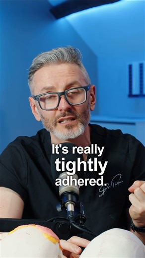 Do this before injecting the nose with filler