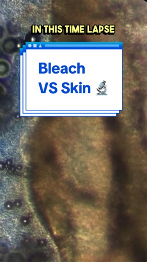 Bleach and soap formation explained under a microscope