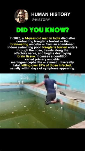 He JUMPED Into Stagnant Water And Got Infected #history #facts