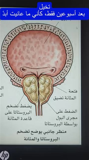 هل تشتكي من مشاكل البروستاتا أو كترة التبول ؟ هل جربت الكــــتير و مافادك ؟ ☹️ نقدم لك كريـــــم طبيعي لعلاج جميع مشاكل البروستات و الإلتهابات البوليه اتحصل على هذا العلاج من هنا : https://www.mahjar.shop/qtprostatecreampk 🔍 فوائد لا تُقاوم: 💪 زيادة في الراحة وتحسين وظائف البروستات. 🌊 تحسين تدفق البول وتقليل التهيج. 🌱 دعم شامل لصحة البروستات. 🌟 لماذا يتميّز منتجنا؟ 🚀 تأثير فوري ونتائج ملموسة. 🛡️ خالٍ من المواد الكيميائية الضارة. 🤲 سهل الاستخدام وسريع الامتصاص دون أي تراكمات | MyShop COD