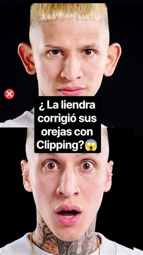 ¿LA LIENDRA CORRIGIÓ SUS OREJAS GRANDES CON CLIPPING CORRECTOR DE OREJAS? 😱🇨🇴 ‪@laliendra_‬