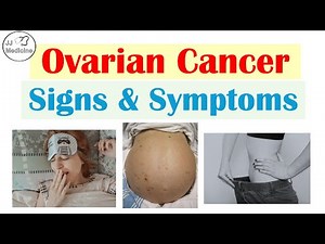 Ovarian Cancer Signs & Symptoms
