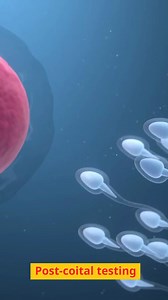 15 reactions | Post-coital test: Fertility Secrets: do you know what...