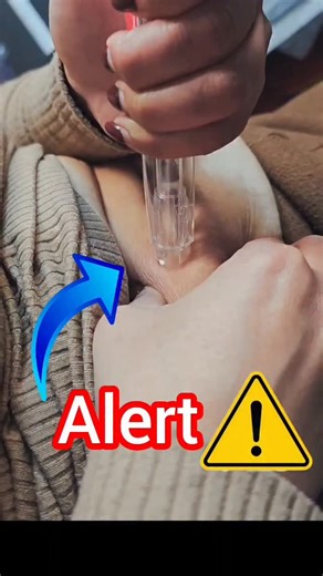 Satish Patel on Instagram: "Injection knowledge Subcutaneous injection #trendingreels #doctor #health #hospital #nursing Hospital knowledge Health knowledge"