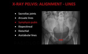 Pelvis