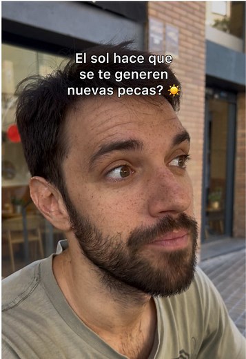 Pecas: ¿Cómo se generan y por qué aparecen más en verano?