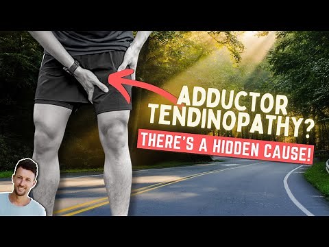 Adductor Tendinopathy | How to Fix it's Hidden Cause!