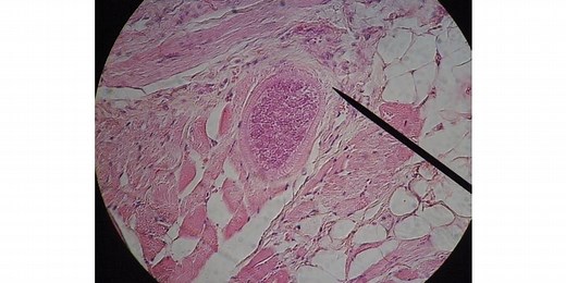 How to Use a Microscope Pointer | Microscope Clarity