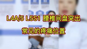 L4A/5 L5S1 腰椎间盘突出常见的疼痛位置