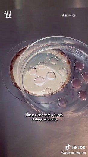 Can you see human eggs with the naked eye? (@shaun.bob) #science #microscope #ivf #satisfying #fyp #foryou