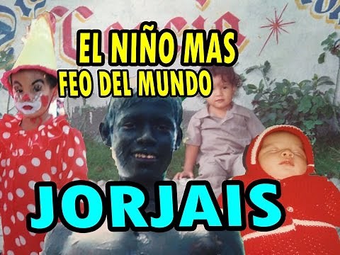 FOTOS EL NIÑO MAS FEO DEL MUNDO JORJAIS