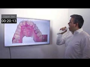 Intra oral scanning – how does it work?