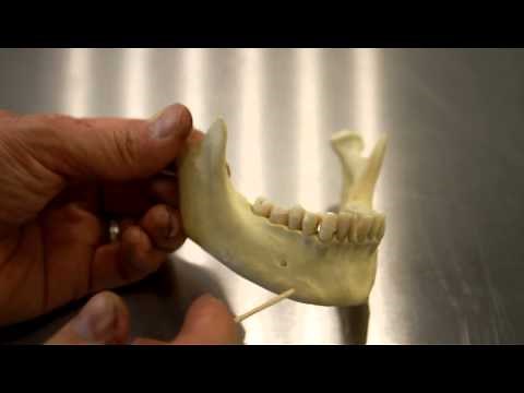 SKELETAL SYSTEM ANATOMY: Mandible