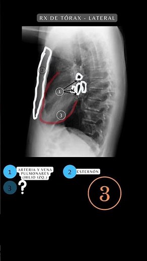 Radiografía de Tórax PA y Lateral | Anatomía de Tórax #radiografía #anatomía #medicina #shorts