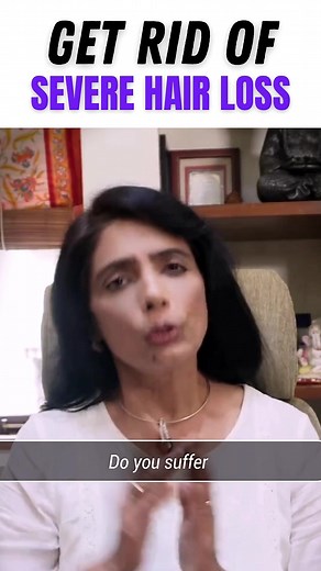 Dealing with severe hair loss?🤔 Don’t worry, there are natural remedies that can help!🌿 In this reel, I’m sharing a simple home remedy that can help promote hair growth and prevent hair loss.🌟 From using Ayurvedic oils to massaging your scalp, these tips are easy to implement and can help improve the health of your hair.💆‍♀️ Say goodbye to hair loss and hello to healthy, luscious locks!🙌🏼 ...Follow Us For More Such Informative & Life Changing Tips🌿....#hairlossremedy #ayurvedicmedicine #n