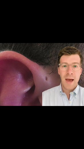 Diagnosing a Preauricular Pit in a 15-Year-Old Boy | Clinical Case 3