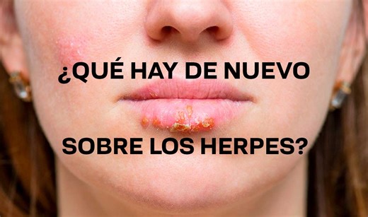 70% de la población mundial infectada por herpes simple 1 - UNAM Global