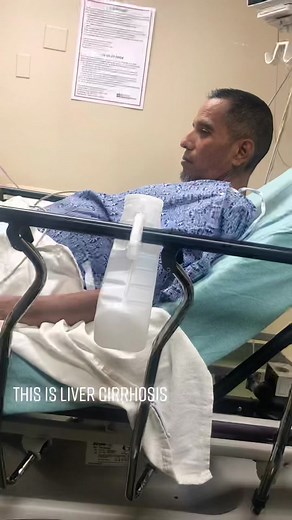 Understanding High Ammonia Levels and Its Health Implications