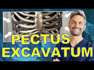 Surgical Options for a Sunken Chest (Pectus Excavatum)