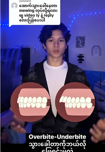 Understanding Overbite and Underbite Dental Issues