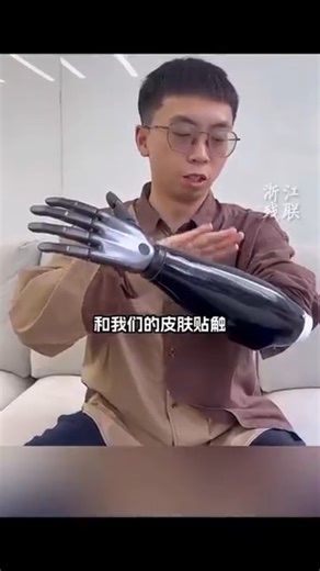 4.1K views · 20 reactions | Artificial bionic hand #bionichand, #bionichands, #bionichandproject, #artificialarm, #artificialfinger, #bionicarm | AmeWhere | Facebook
