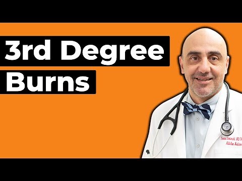 Third Degree Burn: Symptoms and Treatment