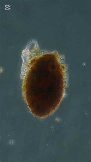 #CapCut #microscopes #microscopetiktok #micrascope