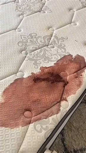 How To Use Bissell Proheat 2x Revolution Pet Pro Carpet Cleaner