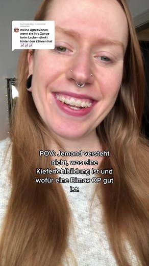 Understanding Bimax and Jawsurgery: A Comprehensive Guide