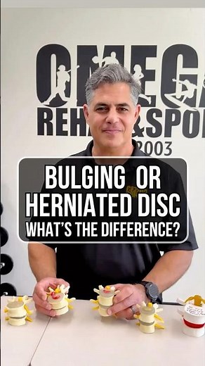 Bulging vs Herniated Disc: The Simple Explanation
