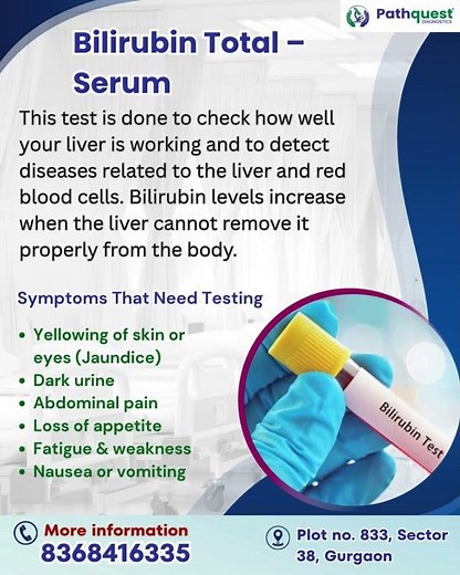 Bilirubin Total – Serum Test | Check Your Liver Health | Pathology lab #liverhealth #bilirubin