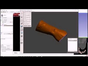 3D Printed Wrist Brace