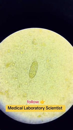 Stool Examination for Parasitic Ova Identification