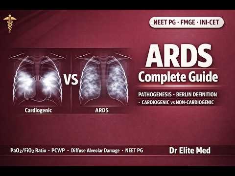 ARDS — Acute Respiratory Distress Syndrome : Pathogenesis, Non-Cardiogenic Pulmonary Edema