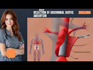 Resection of Abdominal Aortic Aneurysm