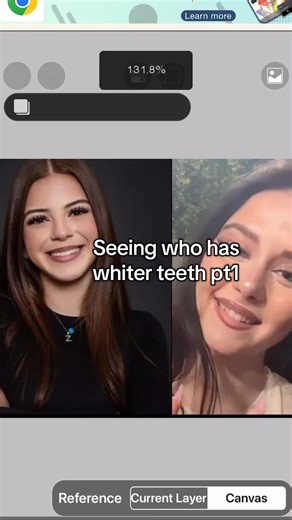 Whiter Teeth Contest: Zahide Takes the Lead in Part 1