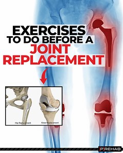 2.1K views · 37 reactions | EXERCISES TO DO BEFORE A JOINT...