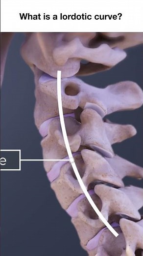 What is a Lordotic Curve in the Cervical Spine?