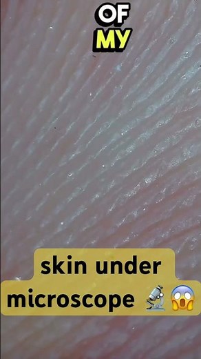 Human Skin Under Microscope 😱 Your Skin Looks Like THIS?!